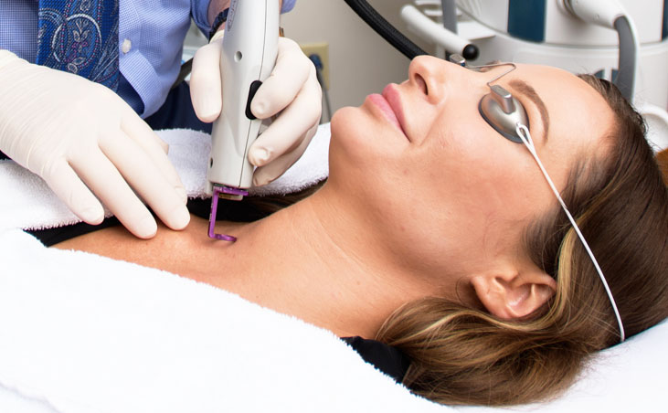 Smooth Sun Damage with Laser Skin Resurfacing