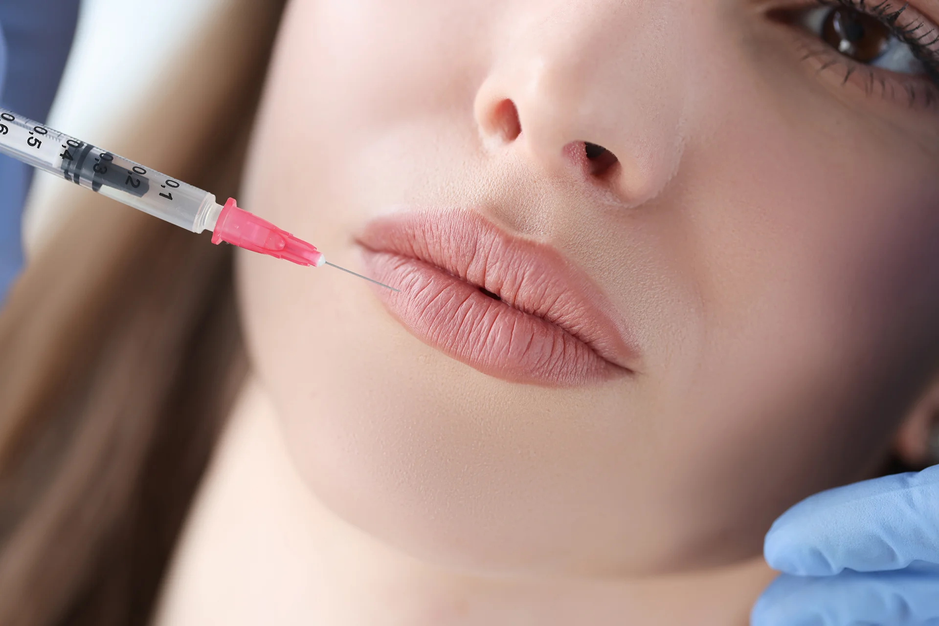 Tailored Russian Lip Filler Treatments