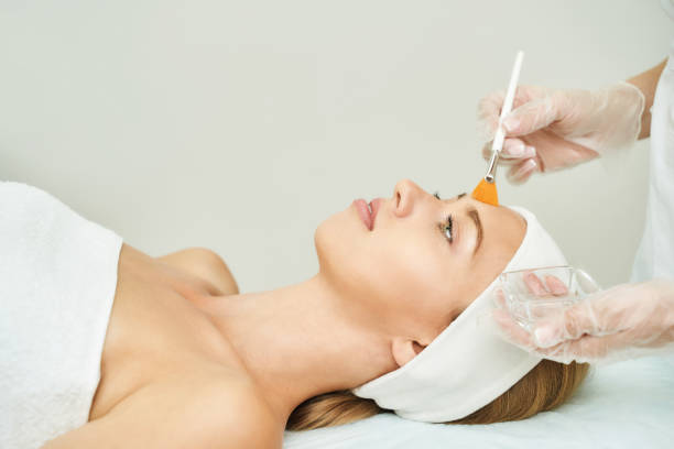 What Is a Chemical Peel and How Does It Work