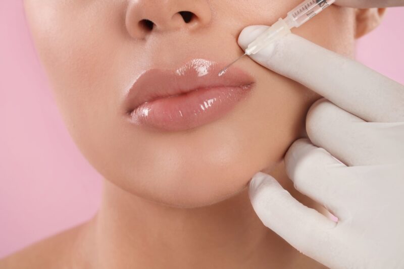 What Makes Lip Filler Different From Botox?