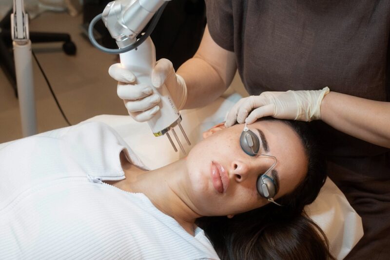 What to Expect After Pico Laser Treatment