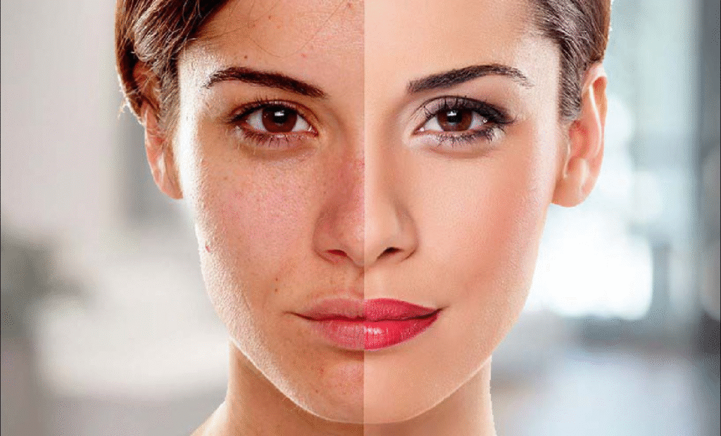 Skin Whitening Treatment Cost