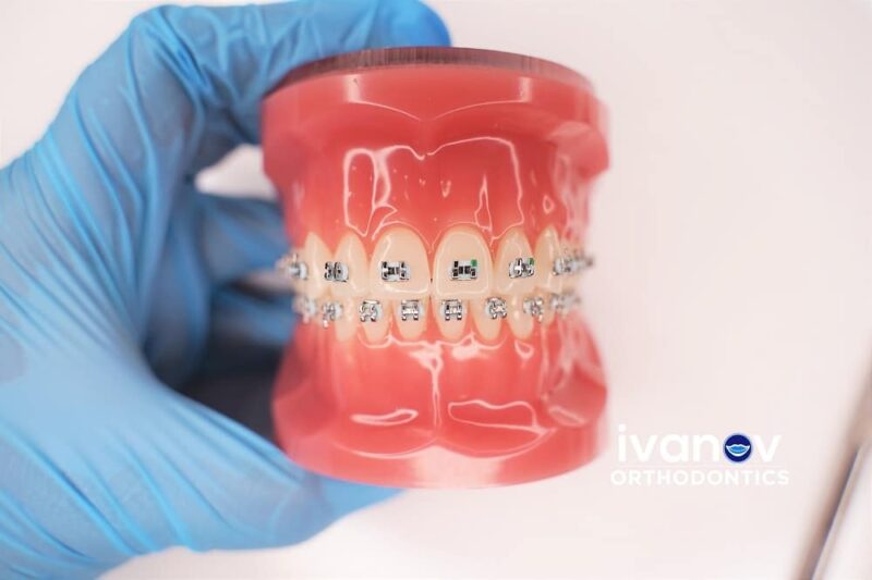 When Should You Visit an Orthodontist in Miami Shores?