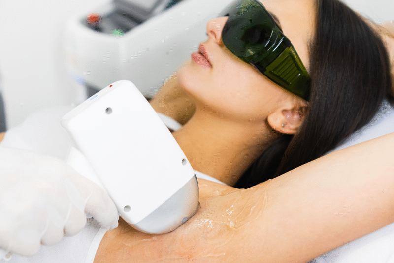 Achieve Effortless Smooth Skin with Laser Hair Removal