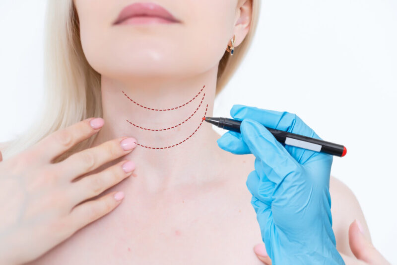 Advanced Neck Rejuvenation Solutions