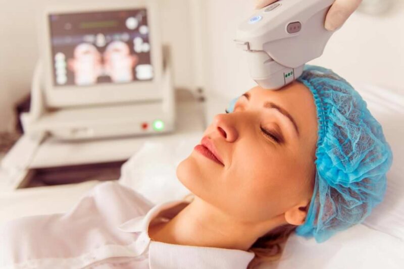 Advanced Skin Lifting with HIFU Treatment