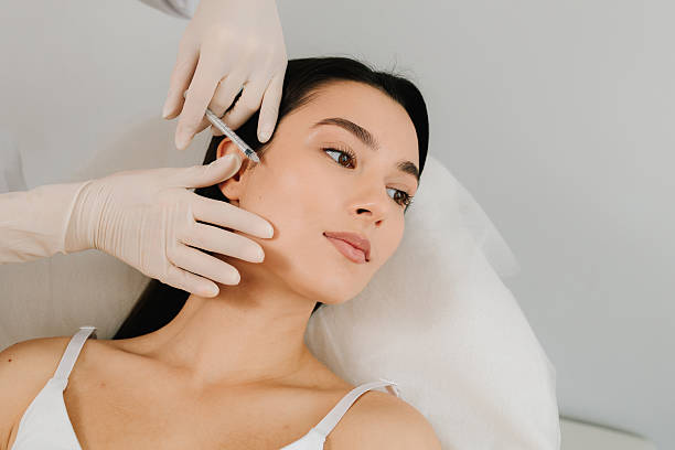 Can Cheek Fillers Injections Improve Smile Lines