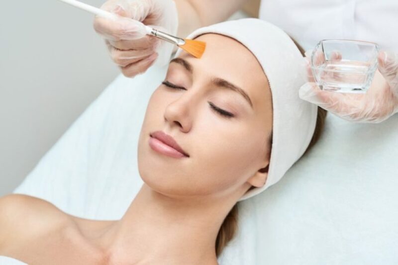 Understanding Different Types of Chemical Peels in Islamabad