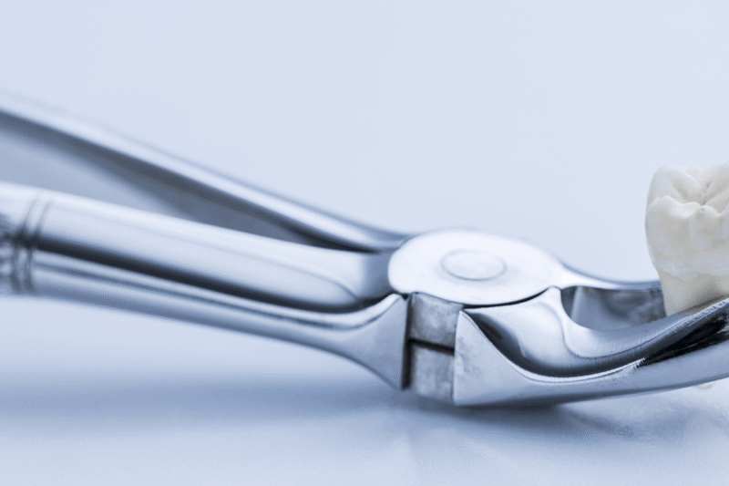 Maintaining and Sterilizing Dental Extraction Forceps for Long-Term Performance