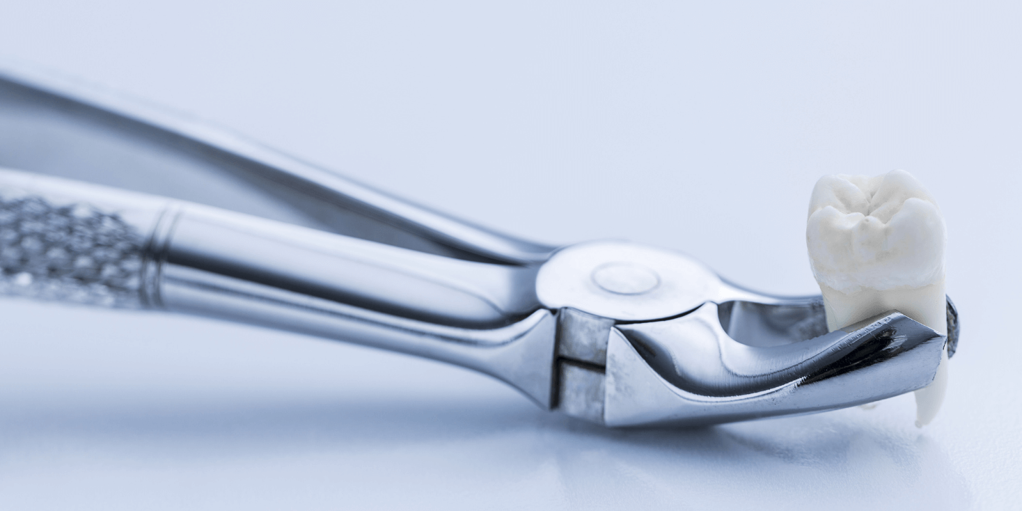 Dental-Extraction-Forceps-1