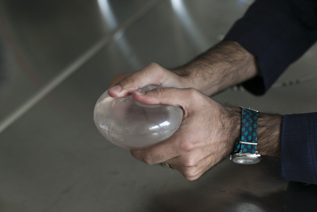 Does Allurion Gastric Balloon Require Removal