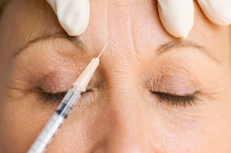 Does Baby Botox Reduce Forehead Wrinkles