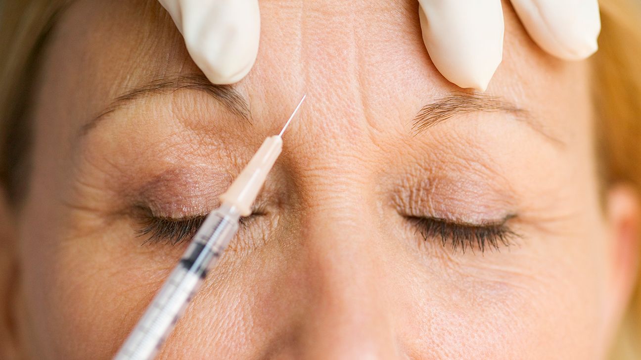 Does Baby Botox Reduce Forehead Wrinkles