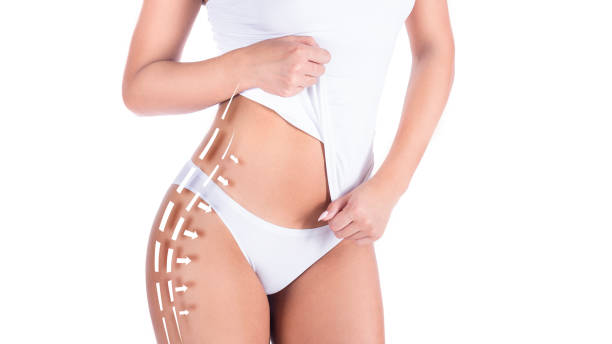 Does Body Contouring Treatment Tighten Skin