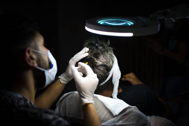 Does GFC Hair Treatment Restore Hair Naturally?