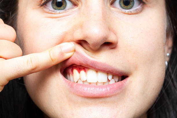 Does Gum Recession Treatment Boost Confidence