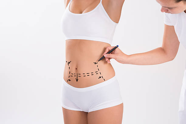 Does Tummy Tuck Leave Visible Scars