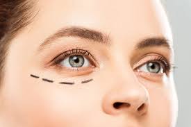 Eyelid Surgery Blepharoplasty