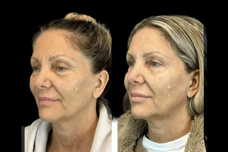 Why Celebrities Trust the Best Aesthetic Clinic in Dubai for Flawless Skin