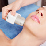 HIFU Treatment for Wrinkle Reduction and Skin Tightening