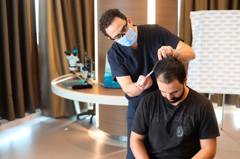 Hair Transplant in Riyadh