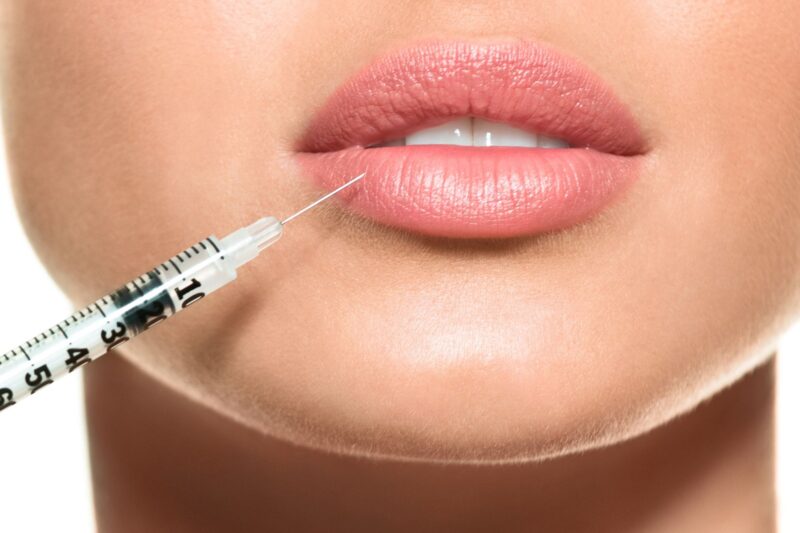 How Effective Are Lip Fillers Injection Options