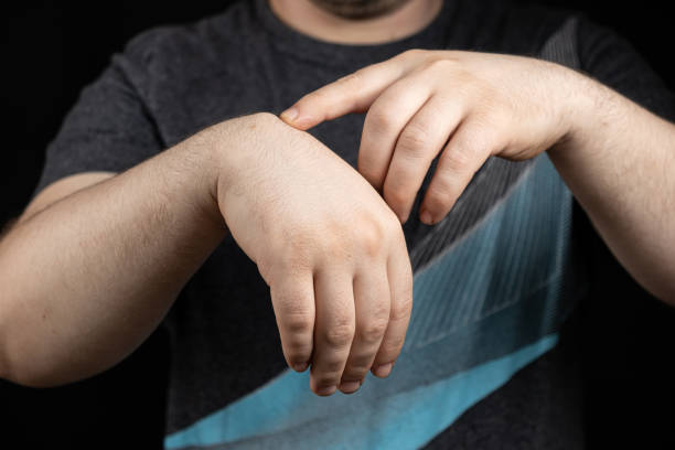 How Effective Is Lipoma Treatment for Large Tumors