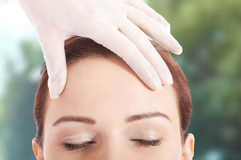 How Long Does a Forehead Lift Last on Average