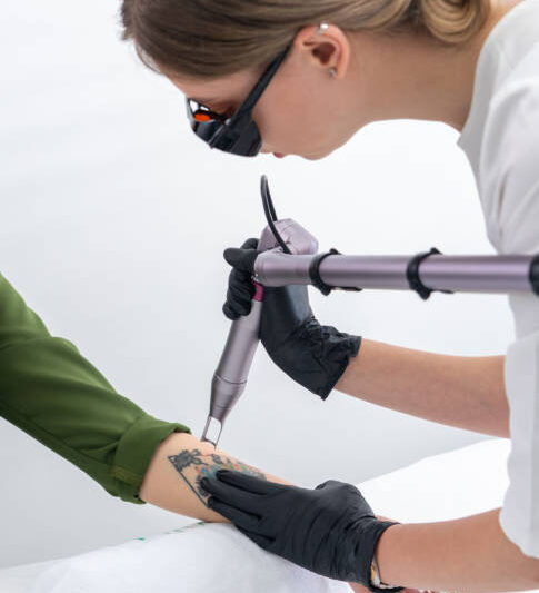 How Many Sessions Are Needed for Picosure Tattoo Removal