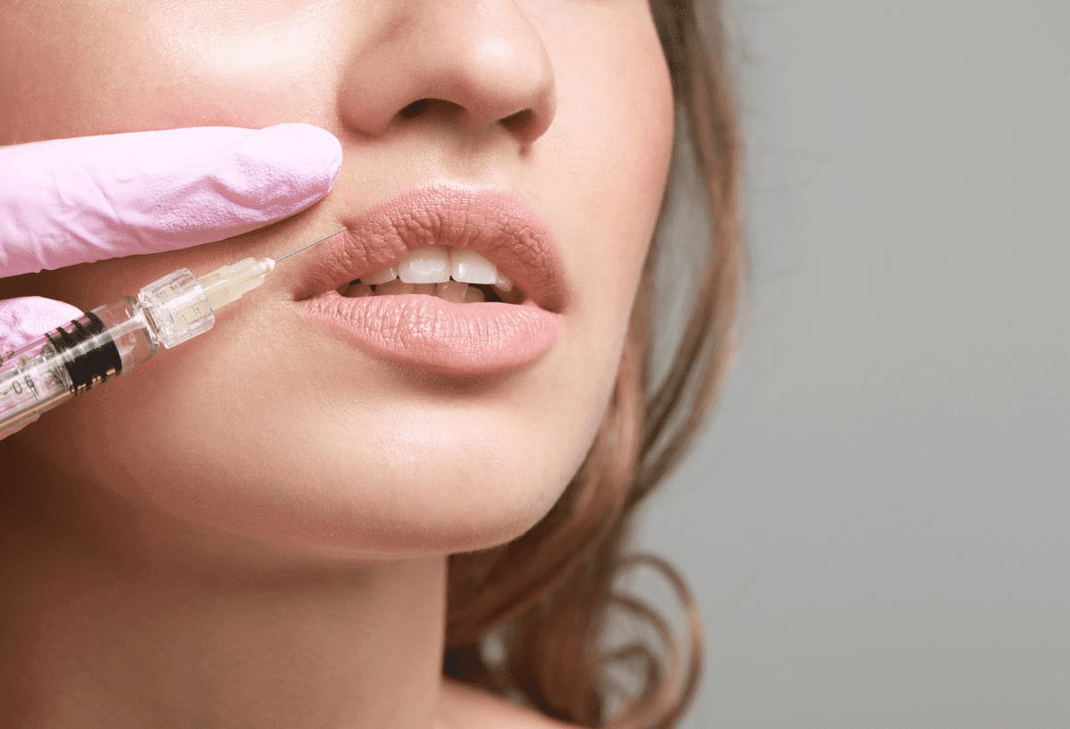 How Often Should You Refresh Lip Fillers