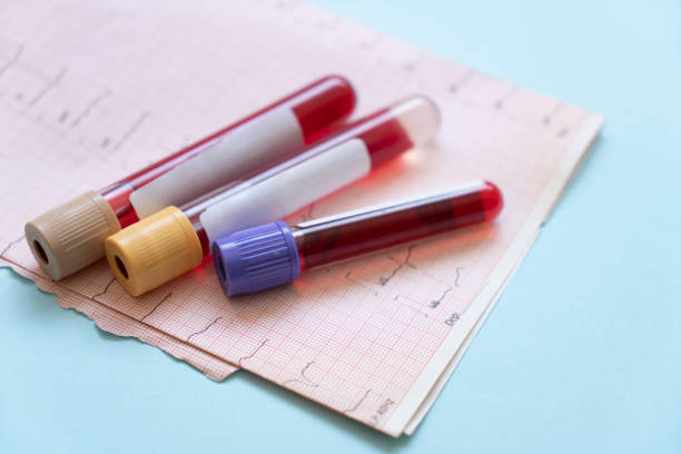 Is a Blood Test Necessary for Every Annual Checkup