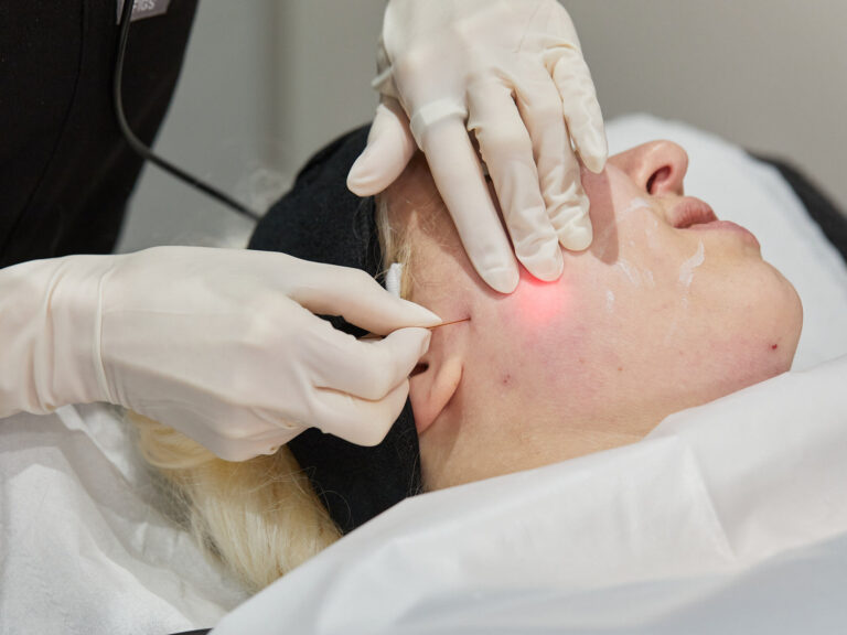 Lift, Tighten, and Rejuvenate with EndoLift