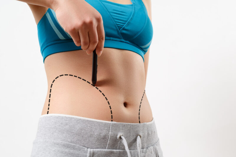 How to Find the Best Vaser Liposuction Surgeons in Dubai for Your Body Goals