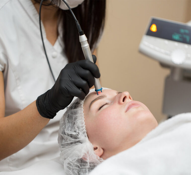 Transform Your Skin with Electrolysis