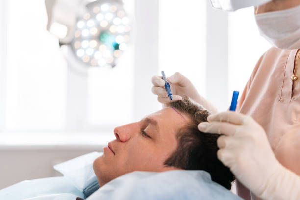 What Hair Transplant Procedure Involves Today