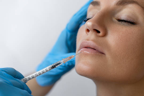 What Makes Lipr Fillers injections So Popular?