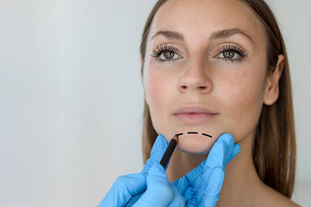 What is Facelift Surgery and How it is Done?