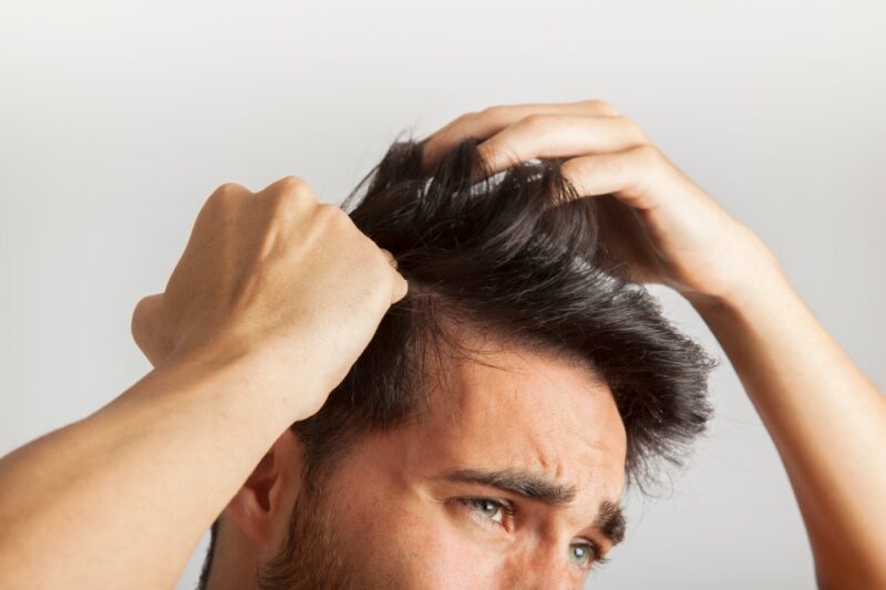 What to Expect After Hair Transplant Treatment