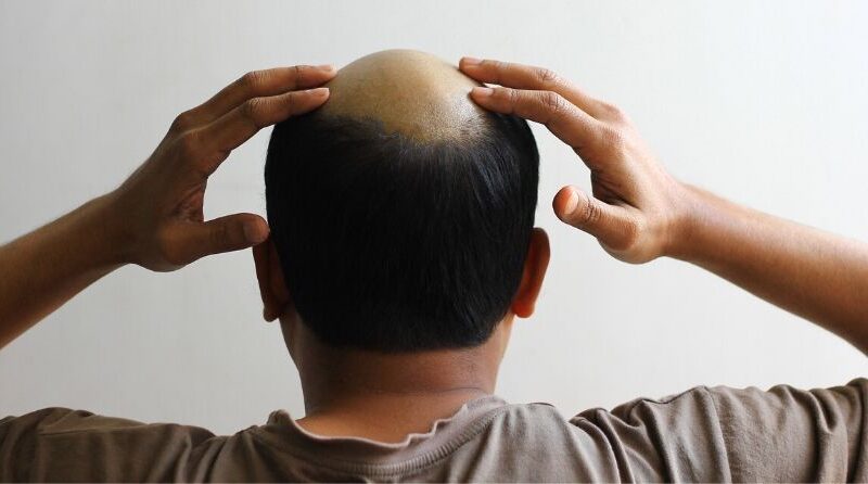 G Cell Treatment for Women: What It Can Do for You