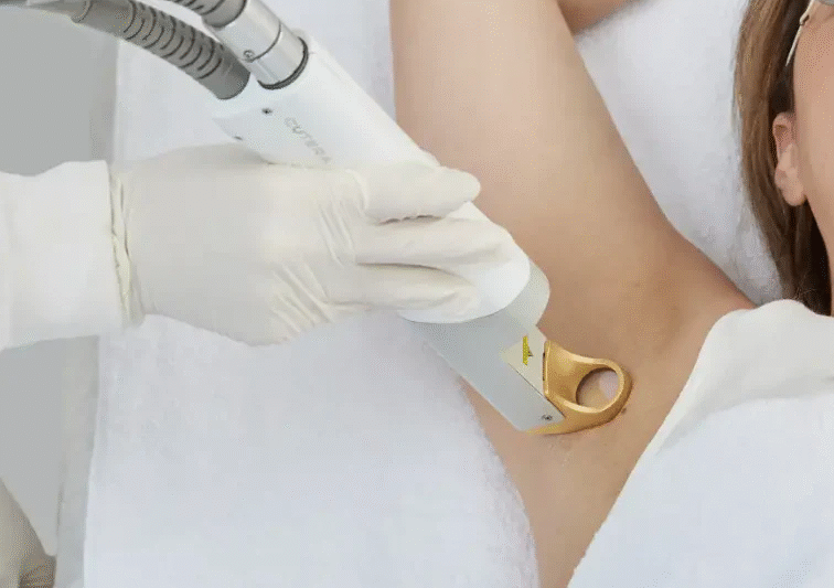 Laser Hair Removal at The Medispa: Safe, Effective & Long-Lasting Hair Reduction