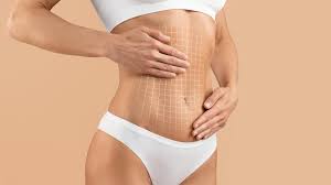 Best Liposuction Surgeon in Dubai with Proven Expertise