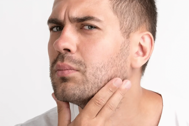 هل ينمو شعر اللحية المزروع؟