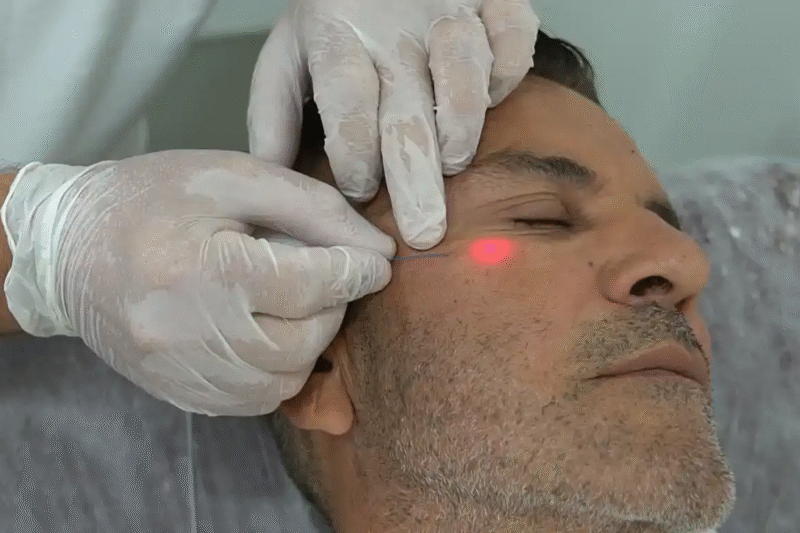 هل يُعالج علاج إندوليفت في أبوظبي الذقن المزدوجة؟