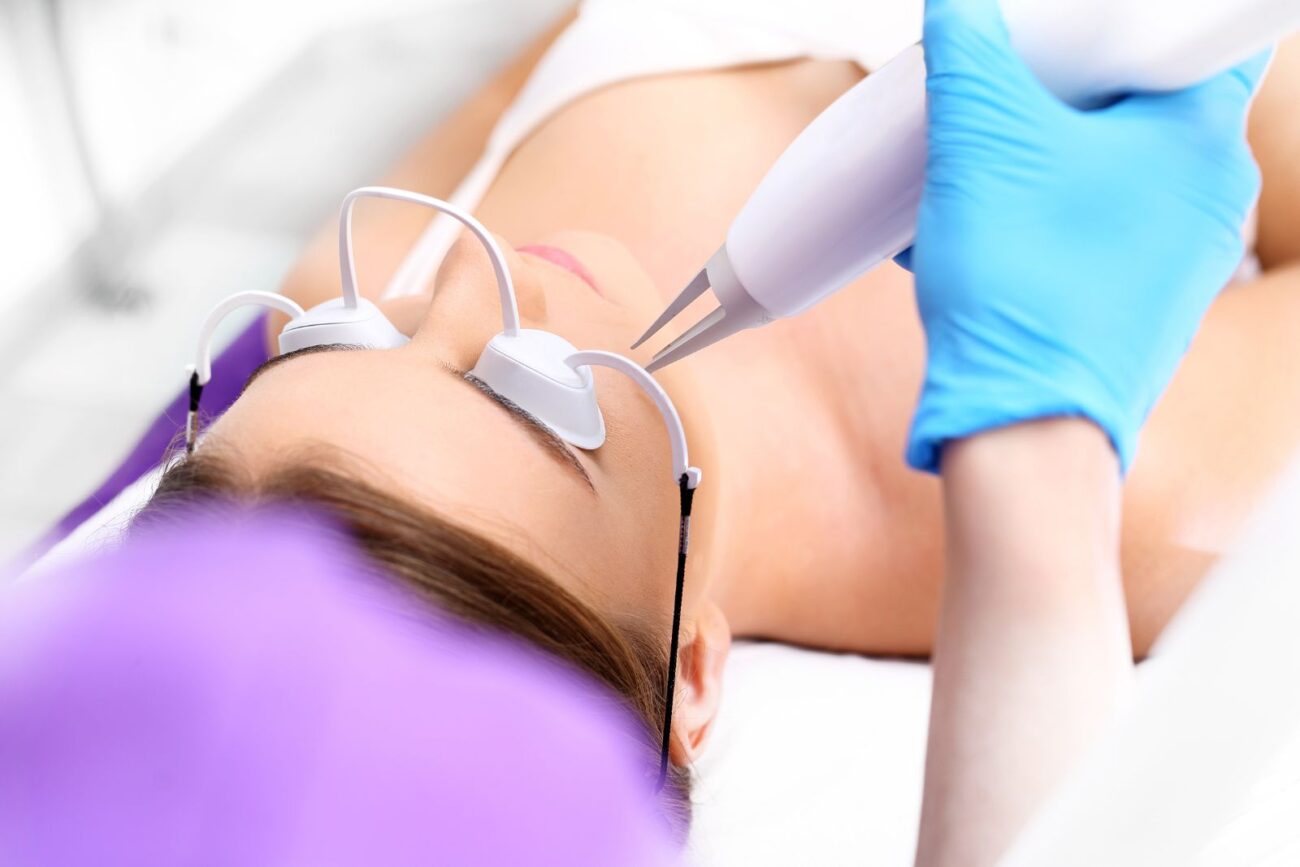 Target Deep Acne Scars with Innovative Laser Solutions
