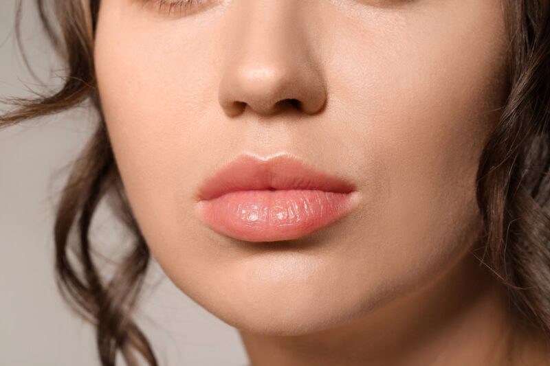 Achieve Symmetry with Lip Reduction Surgery