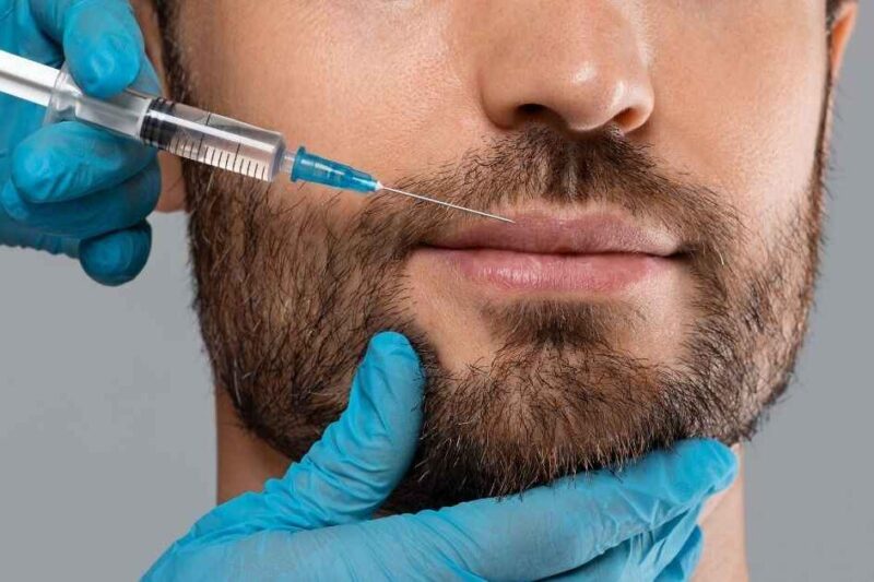 Are Lip Fillers Injections Recommended for Men?