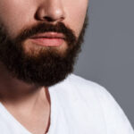 Can Beard Hair Transplant Cover Beard Bald Spots
