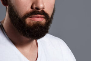 Can Beard Hair Transplant Cover Beard Bald Spots