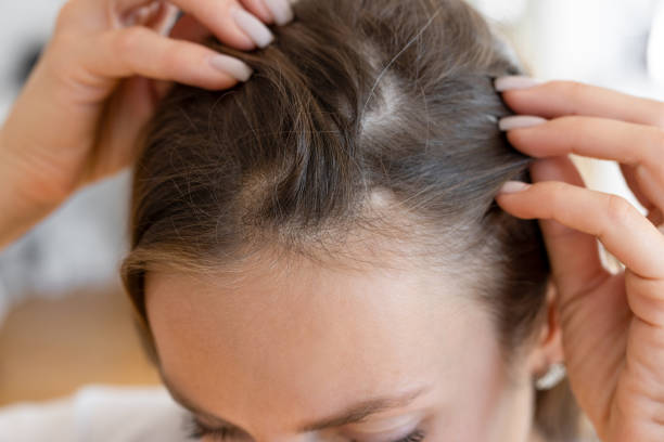 Can Hair Loss & Nail Disorders Be Reversed Fast