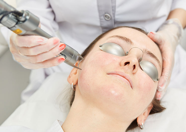 Can Pico Laser Treatment Brighten Dull Skin Tone